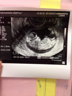 エコー写真