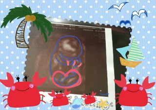 エコー写真