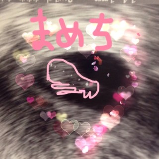 エコー写真