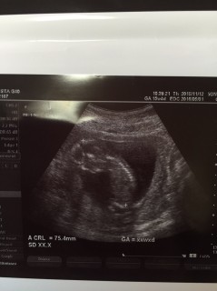 エコー写真