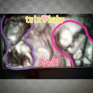 エコー写真