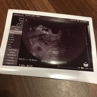 エコー写真