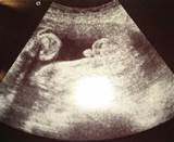 28w