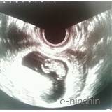 9wのエコー写真